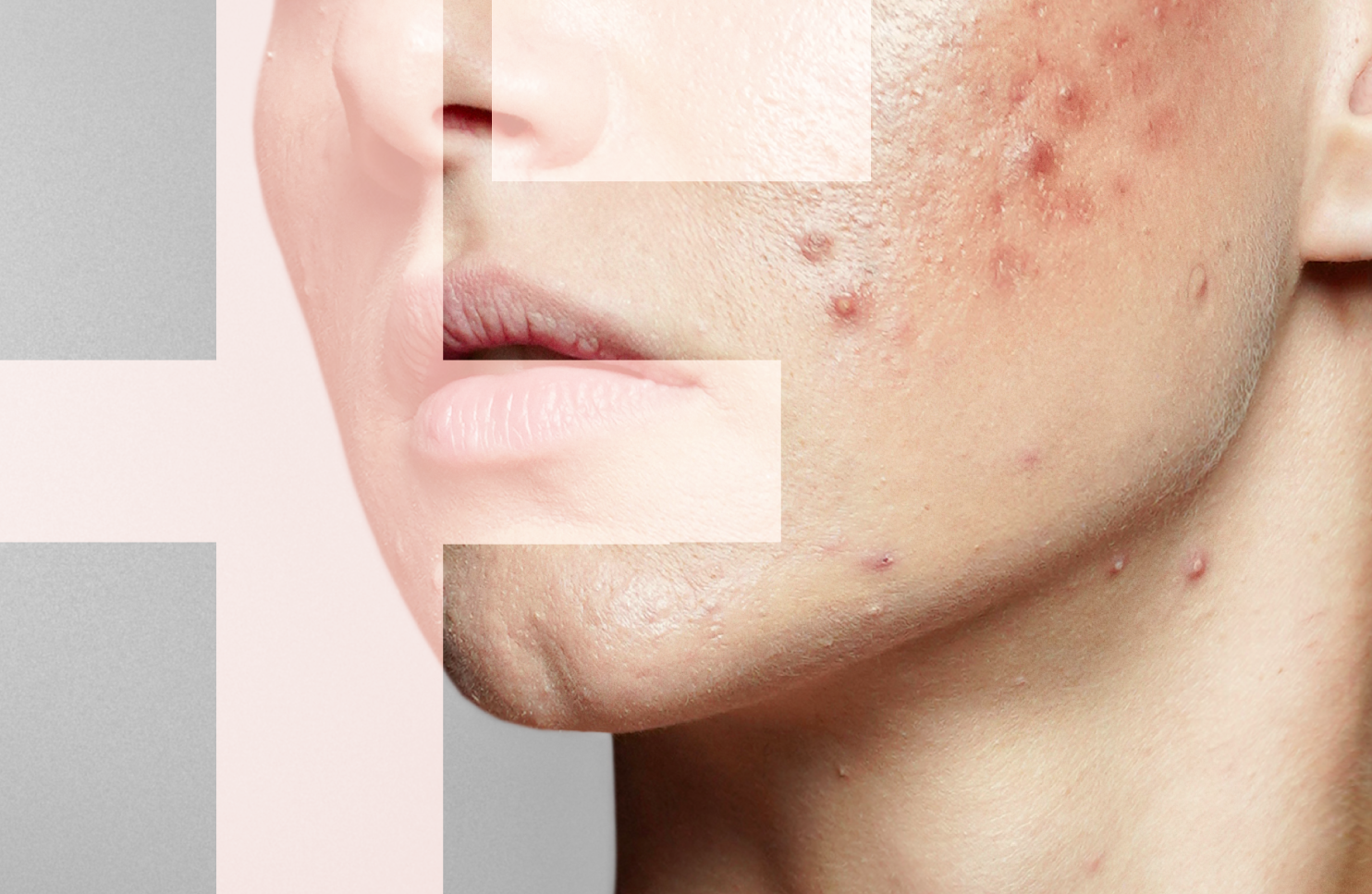 Patologías dermatológicas más comunes
